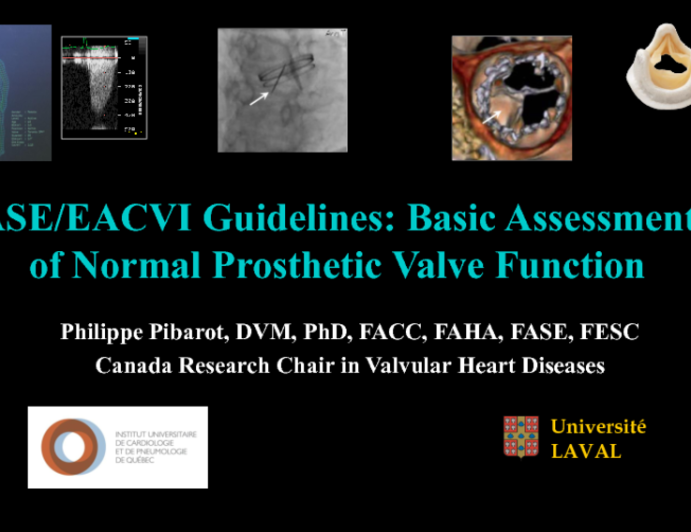ASE/EACVI Guidelines Basic Assessment of Normal Prosthetic Valve